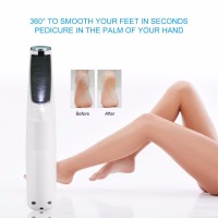 High Quality Battery Operated Dead Skin Remover Tool Feet Callus Remover For Dry Skin